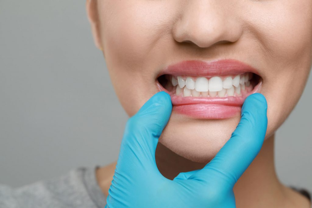 66fac18188f9676b8f34d8fa after professional Teeth Cleaning in Cherry Hills CO
